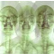 Supergrass